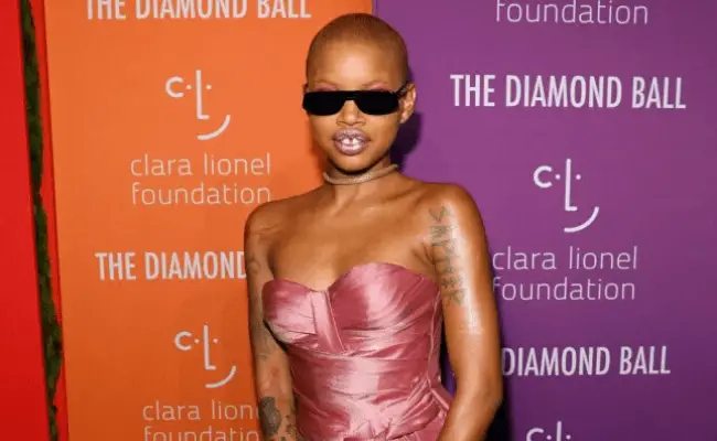 Fenty model, Slick Woods, reveals she has stage three cancer