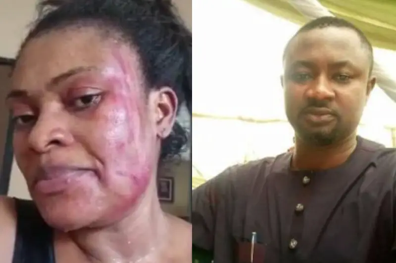 Wife of Nigerian reporter accuses him of battery