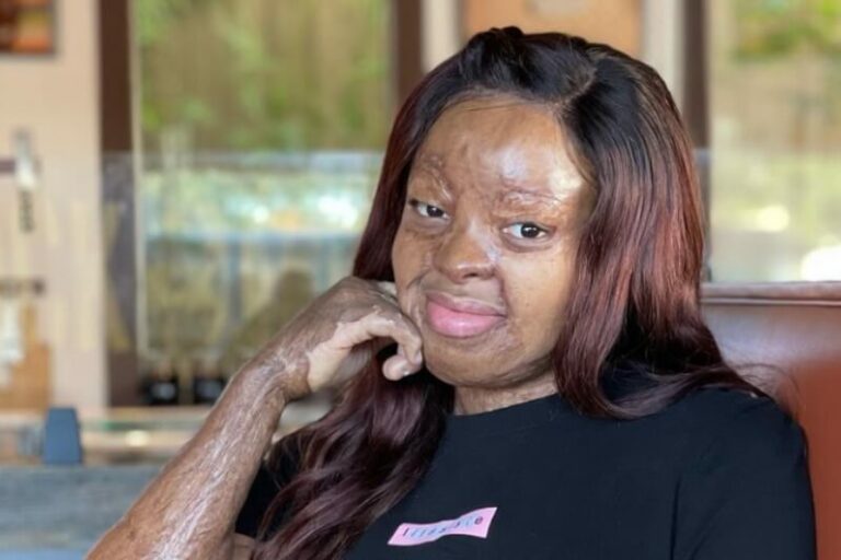 Kechi Okwuchi celebrates 15 years after surviving tragic plane crash