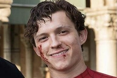 [New photos] Tom Holland bruised on set of "Spider-Man: No Way Home"