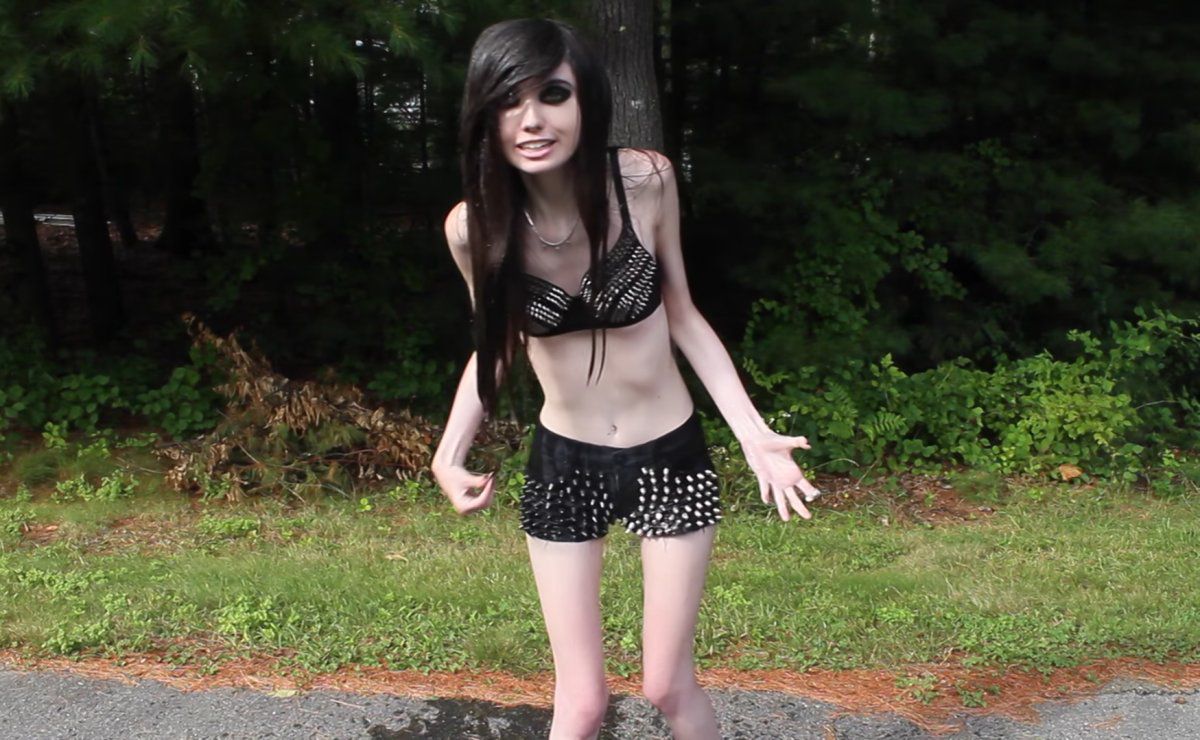 Eugenia Cooney Anorexia controversy.