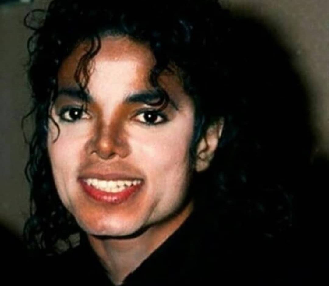Michael Jackson, Winnie Harlow, and other celebrities with vitiligo