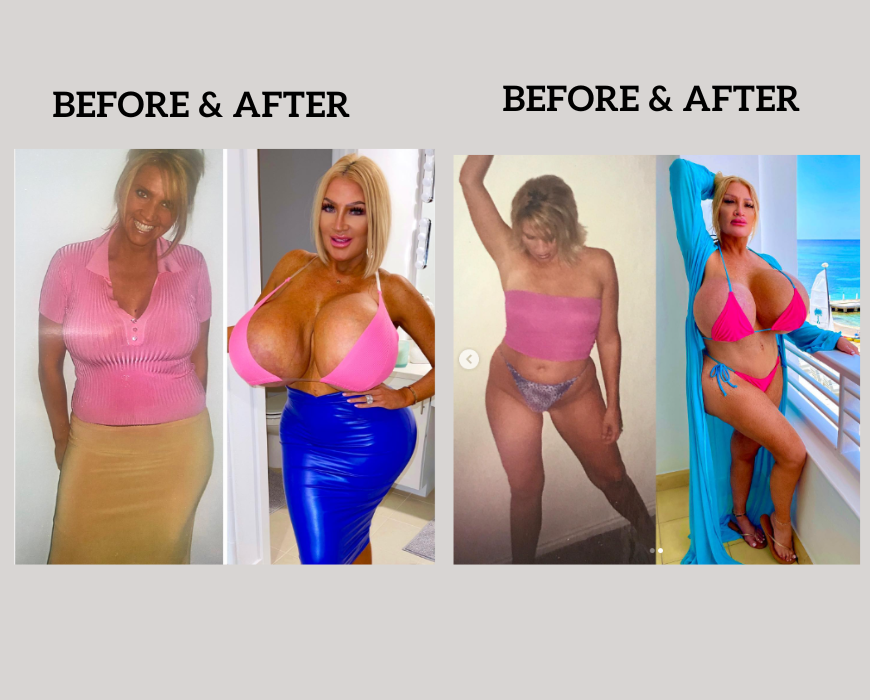 Allegra Cole before and after pictures
